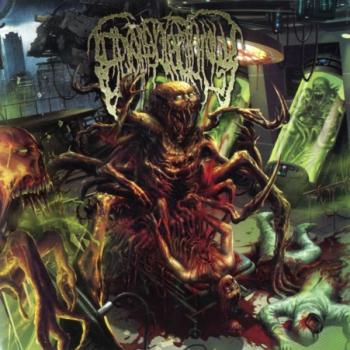 Epicardiectomy - Putreseminal Morphodysplastic Virulency